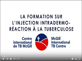 TB Skin Test Training for Health Care Workers (French)